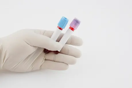 AST Testi Nedir?